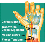 blog_carpal2